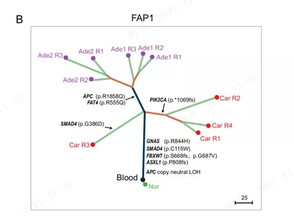 【科研学术】家族性腺瘤性息肉病患者癌变的基因组和转录组分析 【科研学术】家族性腺瘤性息肉病患者癌变的基因组和转录组分析