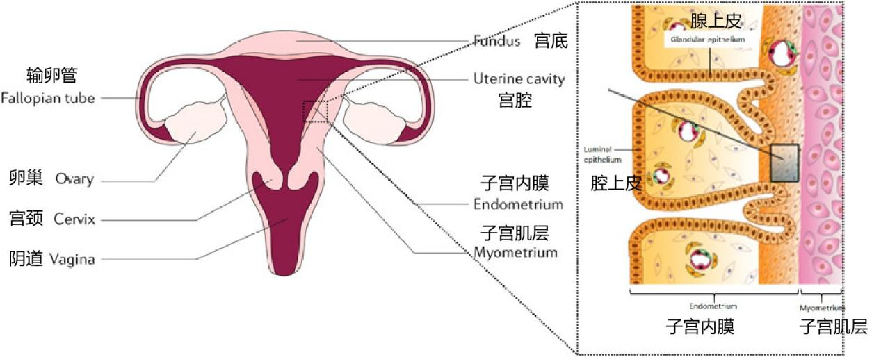 科普 | 全面认识子宫内膜癌
