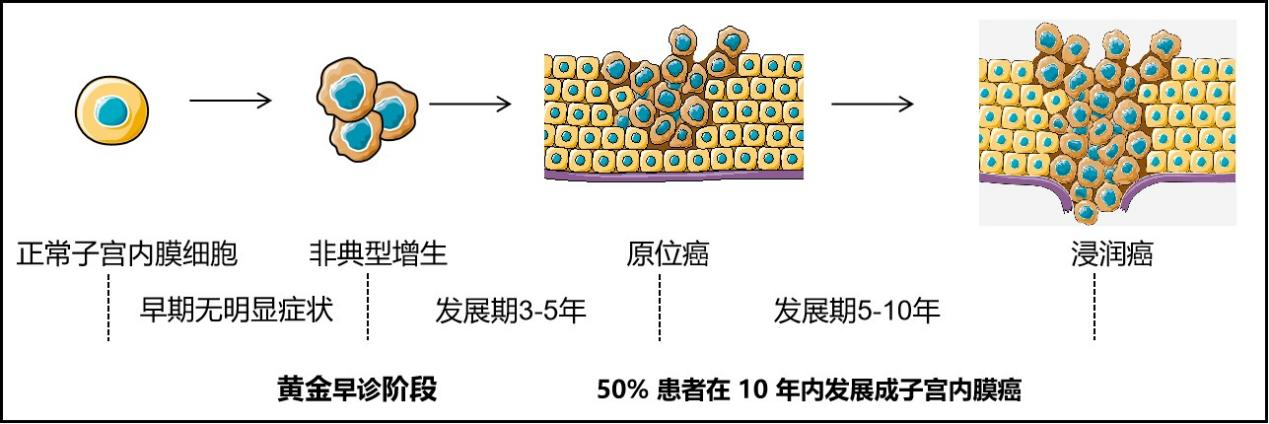 科普 | 全面认识子宫内膜癌