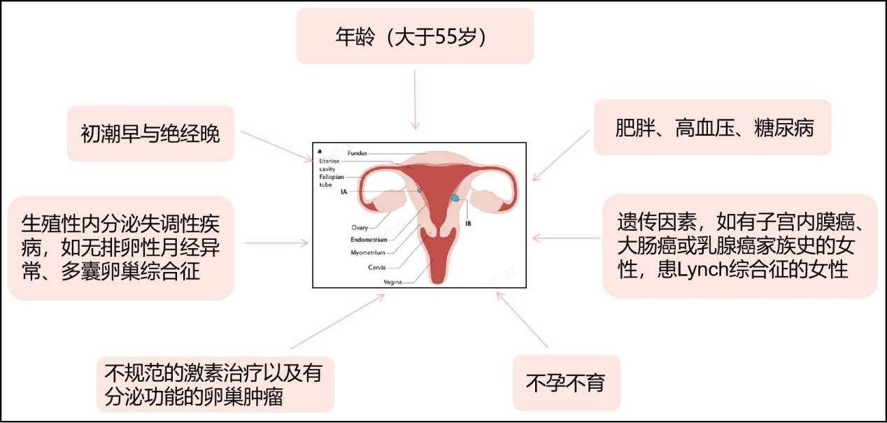 科普 | 全面认识子宫内膜癌